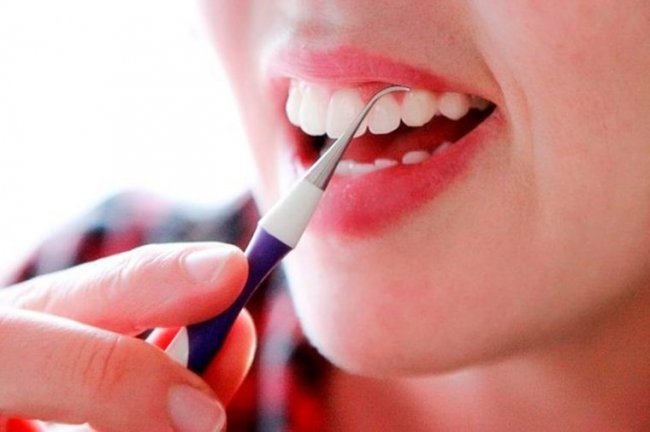 Способы удаления зубного камня в домашних условиях - «Красота и Здоровье»