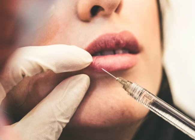 Могут ли филлеры испортить результат подтяжки лица и что с ними происходит в долгосрочной перспективе - «Секреты красоты»